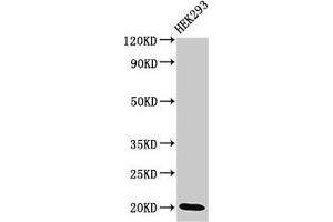 Western Blot Positive WB detected in: HEK293 whole cell lysate All lanes: DLX6 antibody at 3. (DLX6 抗体  (AA 110-171))
