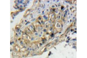 Used in DAB staining on fromalin fixed paraffin-embedded Ovary tissue (TPBG 抗体  (AA 34-356))