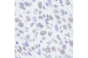 Immunohistochemistry (IHC) image for anti-Scaffold Attachment Factor B (SAFB) (C-Term) antibody (ABIN7448784) (SAFB 抗体  (C-Term))