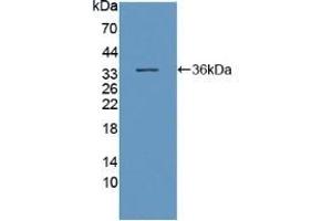 Detection of Recombinant DNAH11, Human using Polyclonal Antibody to Dynein, Axonemal, Heavy Chain 11 (DNAH11) (DNAH11 抗体  (AA 17-299))