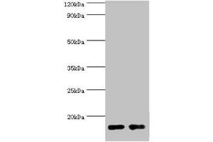 Western blot All lanes: Gastrotropin antibody at 8 μg/mL Lane 1: Mouse small intestine tissue Lane 2: Rat small intestine tissue Secondary Goat polyclonal to rabbit IgG at 1/10000 dilution Predicted band size: 15, 20 kDa Observed band size: 15 kDa (FABP6 抗体  (AA 1-128))