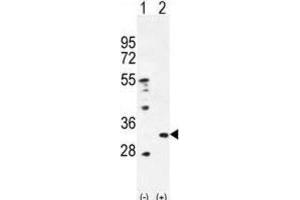 Western Blotting (WB) image for anti-Peroxiredoxin 4 (PRDX4) antibody (ABIN2996535) (Peroxiredoxin 4 抗体)