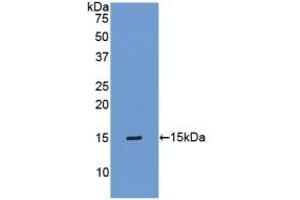 Detection of Recombinant TIMP1, Mouse using Polyclonal Antibody to Tissue Inhibitors Of Metalloproteinase 1 (TIMP1) (TIMP1 抗体  (AA 35-160))