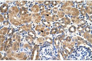 Immunohistochemistry (IHC) image for anti-serine/threonine Kinase 3 (STK3) (C-Term) antibody (ABIN2783469)