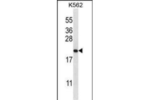 GAGE2B Antibody (N-term) (ABIN657097 and ABIN2837893) western blot analysis in K562 cell line lysates (35 μg/lane).