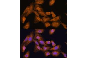 Immunofluorescence (IF) image for anti-Ribosomal Protein L27 (RPL27) (AA 1-136) antibody (ABIN6147127)