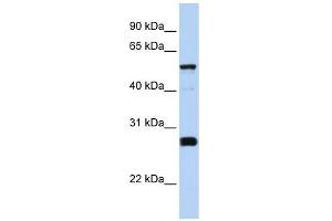 GPRASP2 antibody used at 1 ug/ml to detect target protein. (GPRASP2 抗体  (Middle Region))