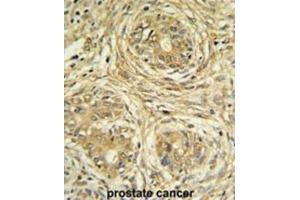 Immunohistochemistry (IHC) image for anti-Suppressor of Var1, 3-Like 1 (SUPV3L1) antibody (ABIN3004313) (SUPV3L1 抗体)