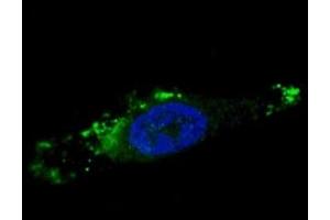 Fluorescent image of chloroquine-treated U251 cells stained with ATG12 antibody. (ATG12 抗体  (AA 1-30))