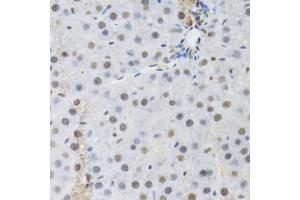 Immunohistochemistry of paraffin-embedded rat liver using RBBP4 Antibody (ABIN5970697) at dilution of 1/100 (40x lens).