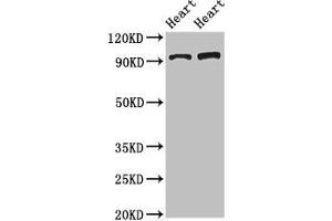 Western Blot Positive WB detected in: Rat heart tissue, Mouse heart tissue All lanes: GPAM antibody at 3. (GPAM 抗体  (AA 281-459))