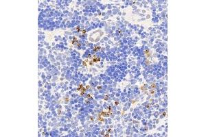 Immunohistochemistry (Paraffin-embedded Sections) (IHC (p)) image for anti-CD177 Molecule (CD177) antibody (ABIN7073372)