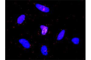 Proximity Ligation Analysis of protein-protein interactions between EGFR and CTNNA1.