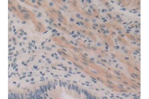 DAB staining on IHC-P; Samples: Mouse Uterus Tissue (ROCK1 抗体  (AA 1094-1323))