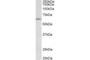 Western Blotting (WB) image for anti-Hypermethylated in Cancer 2 (HIC2) (Internal Region) antibody (ABIN2465146) (HIC2 抗体  (Internal Region))