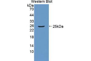 Western blot analysis of the recombinant protein. (RGS5 抗体  (AA 1-181))