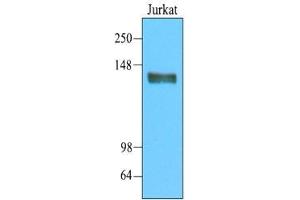 Cell lysates of Jurkat(20 ug) were resolved by SDS-PAGE, transferred to nitrocellulose membrane and probed with anti-human CD45 (1:2000). (CD45 抗体  (AA 1029-1249))