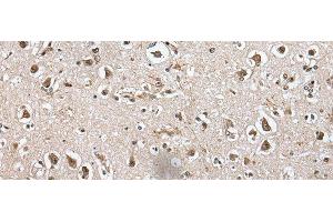 Immunohistochemistry of paraffin-embedded Human brain tissue using METAP1D Polyclonal Antibody at dilution of 1:60(x200) (MAP1D 抗体)