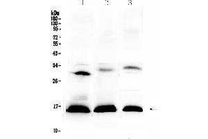 Western blot analysis of HBD using anti-HBD antibody . (HBd 抗体  (AA 2-147))