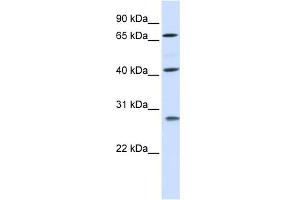 WB Suggested Anti-RDM1 Antibody Titration: 0. (RDM1 抗体  (Middle Region))