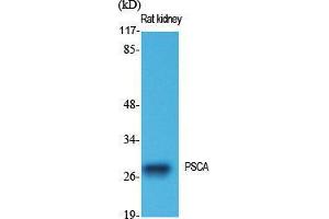 Western Blot (WB) analysis of specific cells using PSCA Polyclonal Antibody. (PSCA 抗体  (Internal Region))