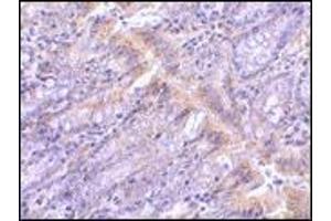 AP20061PU-N PIST antibody staining of Rat Colon tissue by Immunohistochemistry at 1 μg/ml.