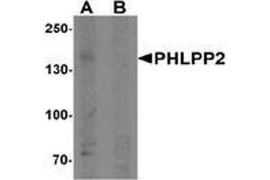 Western blot analysis of PHLPP2 in SW480 cell lysate with PHLPP2 Antibody  at 1 μg/ml in (A) the presence and (B) the absence of blocking peptide. (PHLPP2 抗体  (C-Term))