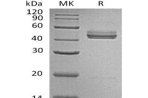 Western Blotting (WB) image for Interleukin 23 (IL23) protein (ABIN7320590) (IL23 蛋白)