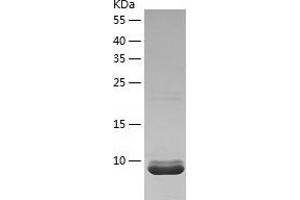 Western Blotting (WB) image for Canopy 1 Homolog (CNPY1) (AA 1-92) protein (His tag) (ABIN7122118) (CNPY1 Protein (AA 1-92) (His tag))
