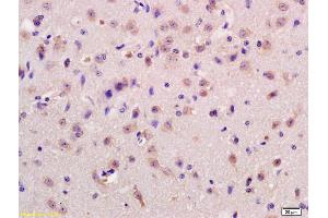 Immunohistochemistry (IHC) image for anti-G Protein-Coupled Receptor 37 (Endothelin Receptor Type B-Like) (GPR37) (AA 201-300) antibody (ABIN1713825)