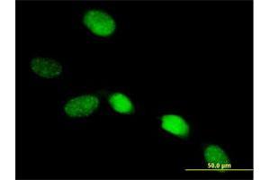 Immunofluorescence of purified MaxPab antibody to SOX13 on HeLa cell. (SOX13 抗体  (AA 1-622))