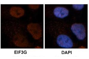 Immunohistochemical staining of human brain stem cells with EIF3G polyclonal antibody . (EIF3G 抗体  (AA 218-267))