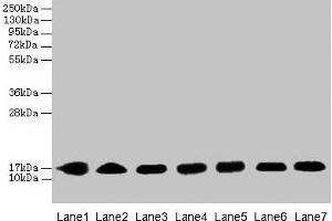 Western blot All lanes: CYB5B antibody at 0. (CYB5B 抗体  (AA 2-118))