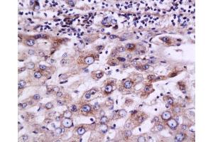 Immunohistochemistry (Paraffin-embedded Sections) (IHC (p)) image for anti-ATP-Binding Cassette, Sub-Family C (CFTR/MRP), Member 2 (ABCC2) (AA 485-615) antibody (ABIN737541)