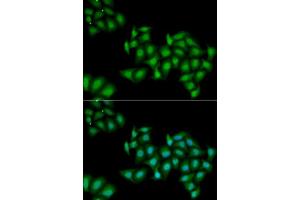 Immunofluorescence analysis of MCF7 cells using DDX1 antibody. (DDX1 抗体  (AA 441-740))