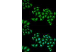 Immunofluorescence analysis of MCF7 cells using DDX1 antibody. (DDX1 抗体  (AA 441-740))