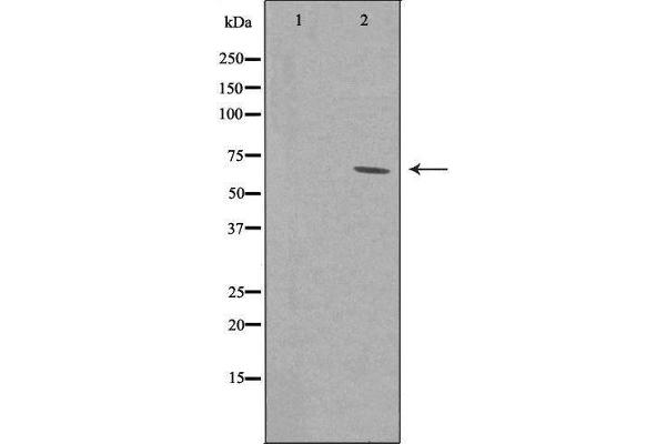 ZNF460 anticorps  (C-Term)