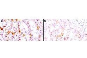 Immunohistochemistry using  anti-mesothelin antibodies to detect mesothelin in PEFF human tissue sections treated by antigen retrieval methods. (Mesothelin 抗体  (Extracellular, Extracellular Domain))