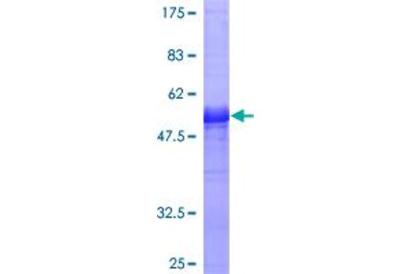 PPP2R3B Protein (AA 1-176) (GST tag)