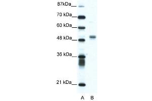 WB Suggested Anti-FLI1  Antibody Titration: 1. (FLI1 抗体  (N-Term))