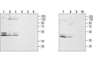 Western blot analysis of rat hippocampus, DRG (lanes 2 and 5), brain (lanes 3 and 6), mouse brain (lanes 7 and 9) and human prostate carcinoma LNCaP cell lysates: - 1,2,3,7,8. (GALR2 抗体  (3rd Intracellular Loop))