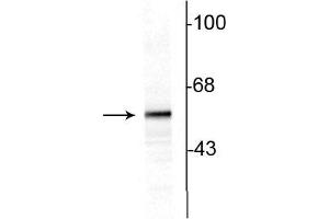 Western blot of 10ug of rat striatal lysate showing specific immunolabeling of the ~60 kDa tyrosine hydroxylase protein. (Tyrosine Hydroxylase 抗体)
