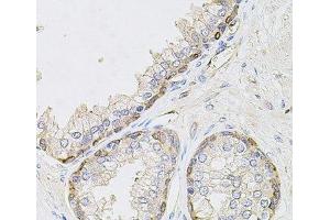 Immunohistochemistry of paraffin-embedded Human prostate using CIB1 Polyclonal Antibody at dilution of 1:100 (40x lens). (CIB1 抗体)