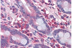 Human Small Intestine: Formalin-Fixed, Paraffin-Embedded (FFPE) (DPF2 抗体  (AA 56-155))