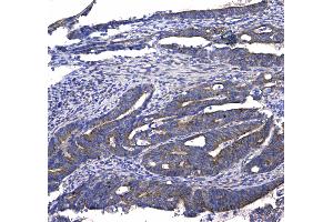 IHC analysis of GSTM3 using anti-GSTM3 antibody . (GSTM3 抗体  (AA 93-206))