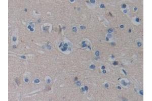 Immunohistochemistry (IHC) image for anti-Biglycan (BGN) (AA 230-366) antibody (ABIN7438334)