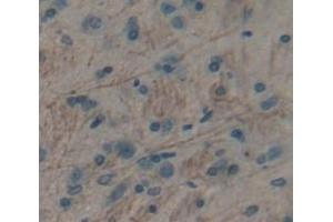 IHC-P analysis of brain tissue, with DAB staining. (TRPM7 抗体  (AA 19-179))