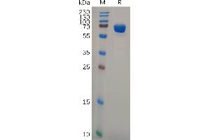 SDS-PAGE (SDS) image for Bone Marrow Stromal Cell Antigen 1 (BST1) (AA 29-292) protein (Fc Tag) (ABIN7092796)