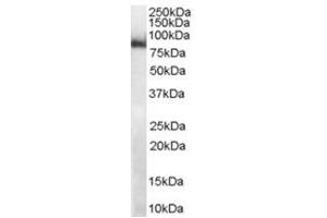 Image no. 2 for anti-Midline 2 (MID2) (C-Term) antibody (ABIN374299) (Midline 2 抗体  (C-Term))