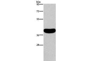 Western Blot analysis of Human normal colon tissue using CRELD2 Polyclonal Antibody at dilution of 1:550 (CRELD2 抗体)